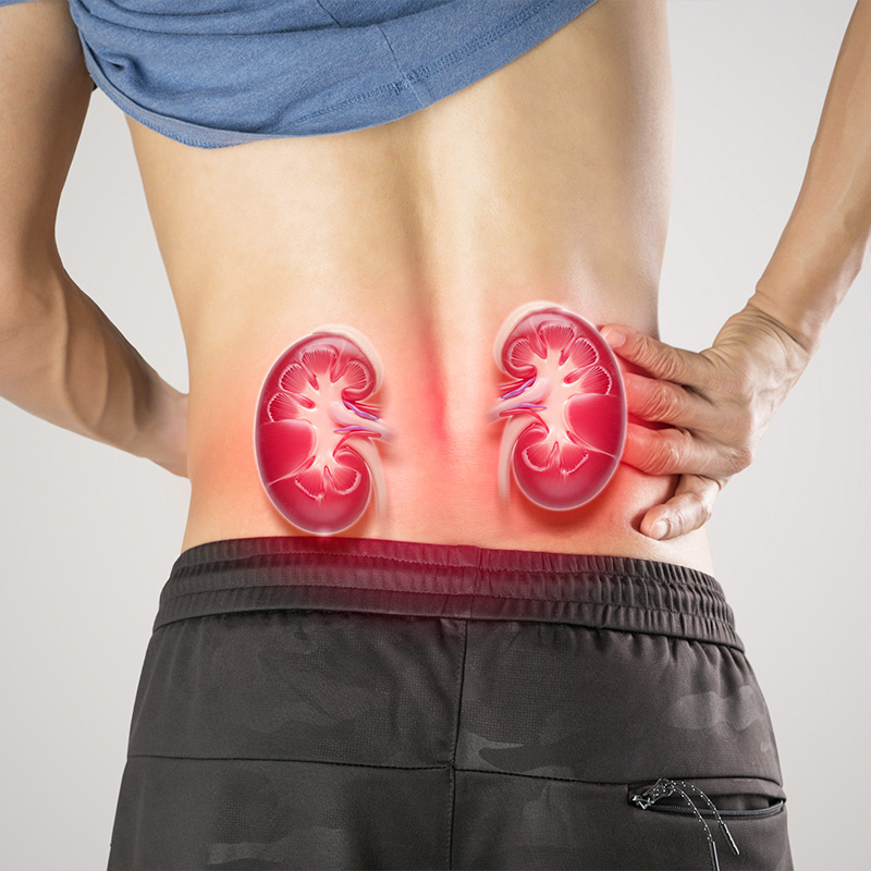 慢性腎臓病（CKD）